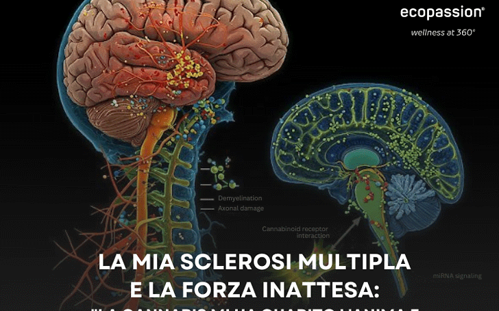 La mia sclerosi multipla e la forza inattesa: "La cannabis mi ha guarito l'anima e tenuto in vita"