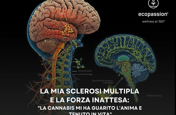 La mia sclerosi multipla e la forza inattesa: "La cannabis mi ha guarito l'anima e tenuto in vita"