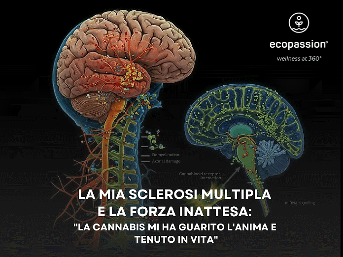 La mia sclerosi multipla e la forza inattesa: &quot;La cannabis mi ha guarito l&#039;anima e tenuto in vita&quot;