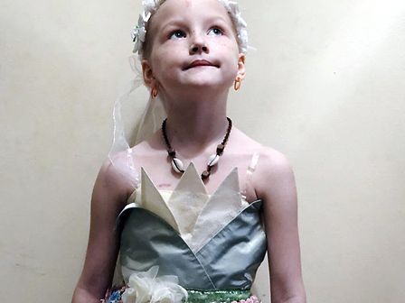 Bimba di 8 anni sconfigge la leucemia anche grazie all&amp;#039;estratto di cannabis