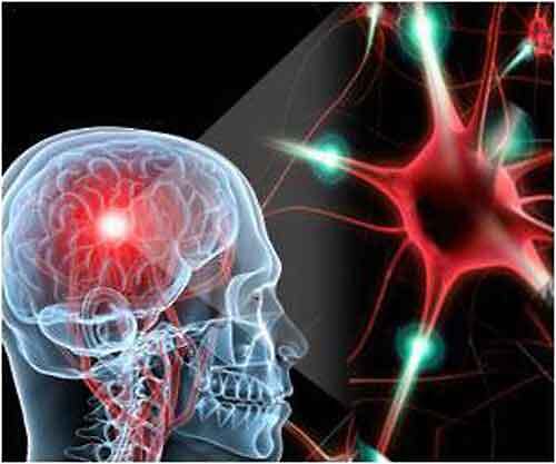 Cancro al cervello: al via il primo studio su pazienti con un trattamento a base di cannabis