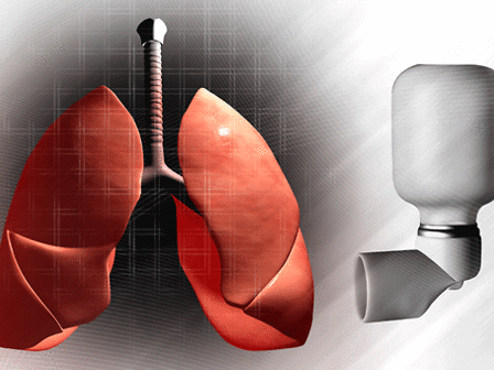 Asma: un nuovo studio spiega come il THC possa aiutare a respirare meglio
