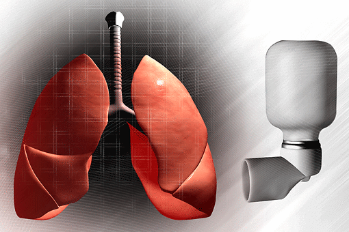 Asma: un nuovo studio spiega come il THC possa aiutare a respirare meglio