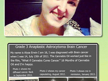 Alysa Erwin: &amp;quot;Ho sconfitto un tumore terminale al cervello con l&amp;#039;estratto di cannabis&amp;quot;