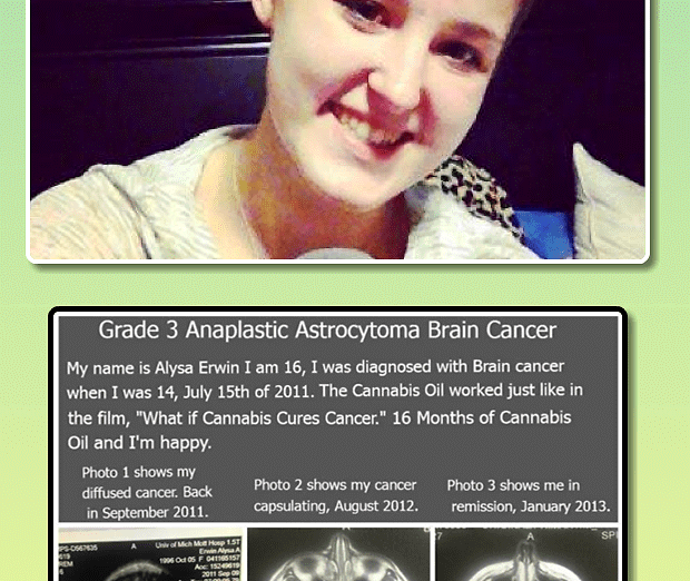 Alysa Erwin: &quot;Ho sconfitto un tumore terminale al cervello con l&#039;estratto di cannabis&quot;