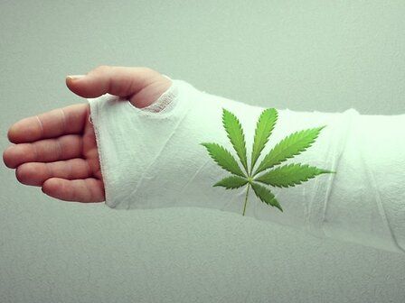 Fratture ossee e CBD: le proprietà analgesiche e riparatrici dei cannabinoidi